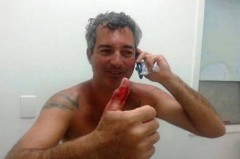 Joe mostra o dedo mordido pelo tubarão (Foto Divulgação Folha de Búzios)